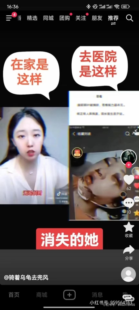 2025年网友持续声援李宜雪 网传其已被切除额前叶 2 id14403705 signal 2025 01 01 232441 002 450x1000 1